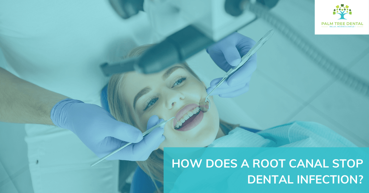 How  Does a Root Canal Stop Dental Infection?