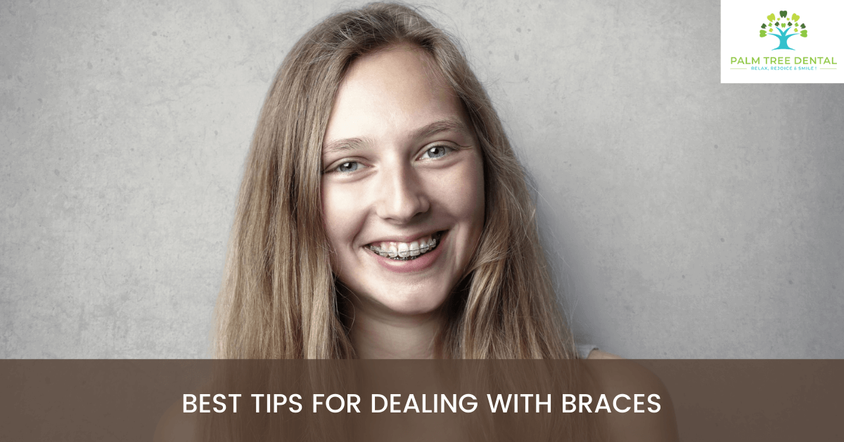 Best Tips for Dealing with Braces
