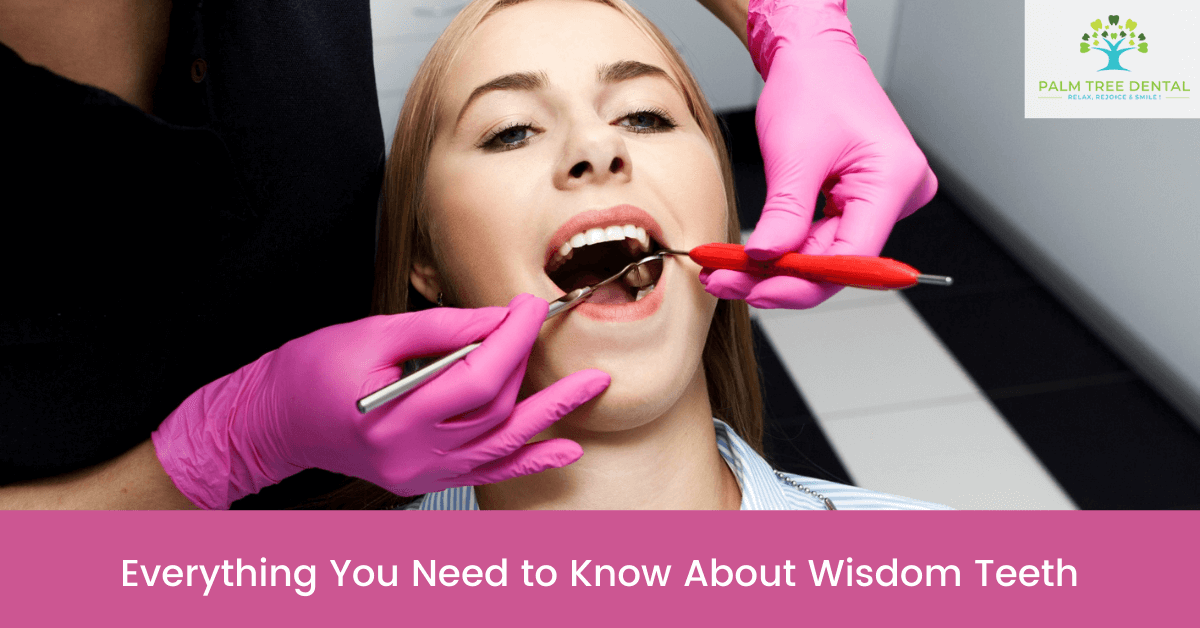Everything You Need to Know About Wisdom Teeth