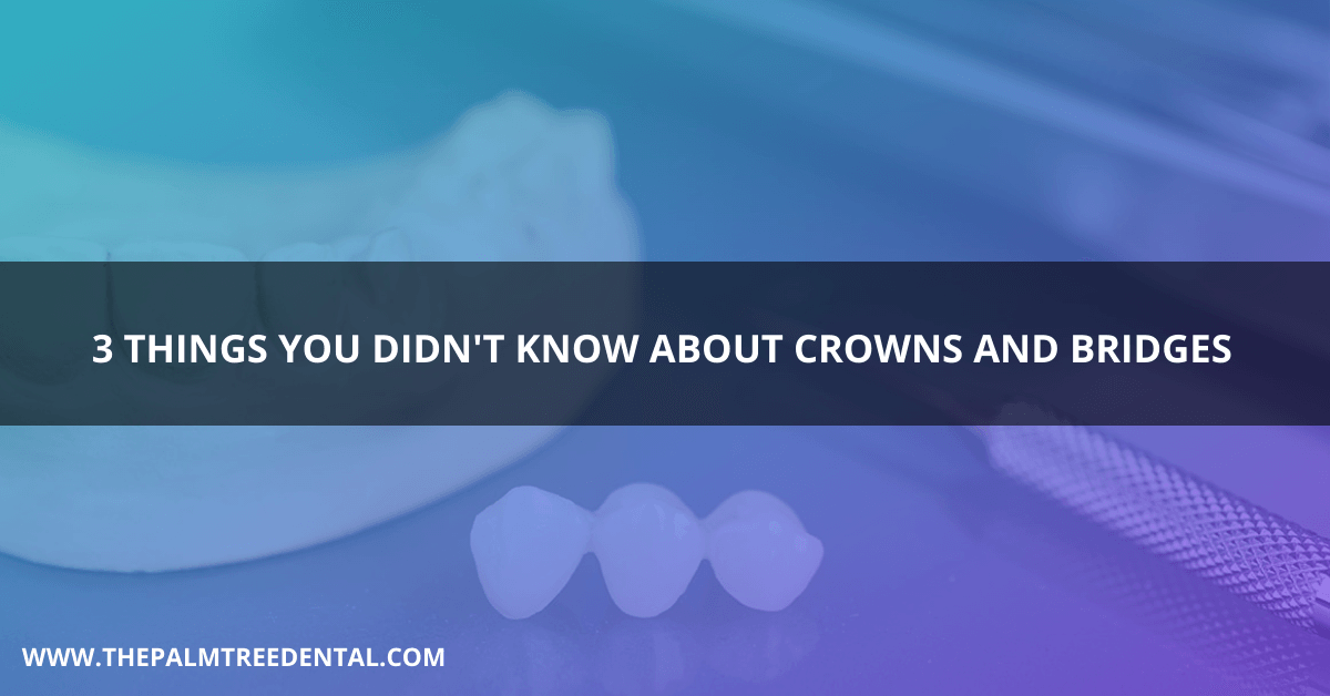 3 Things You Didn't Know About Crowns and Bridges