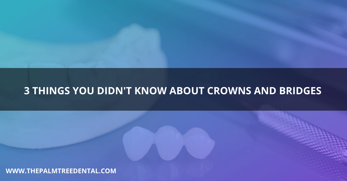 3 Things You Didn’t Know About Crowns and Bridges