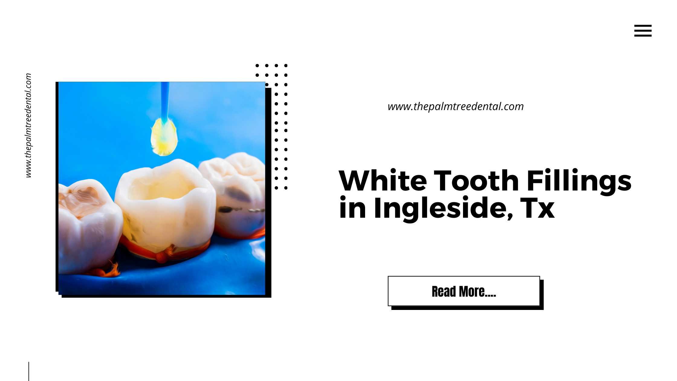 White Tooth Fillings in Ingleside, Tx
