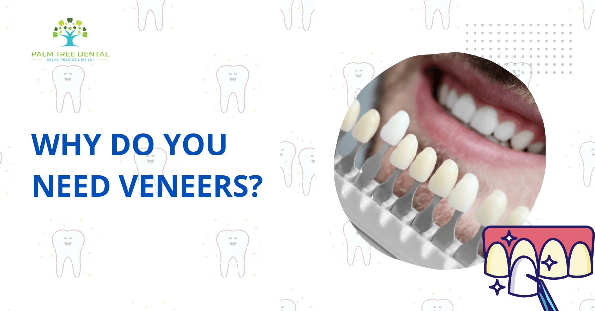 Why Do You Need Veneers?
