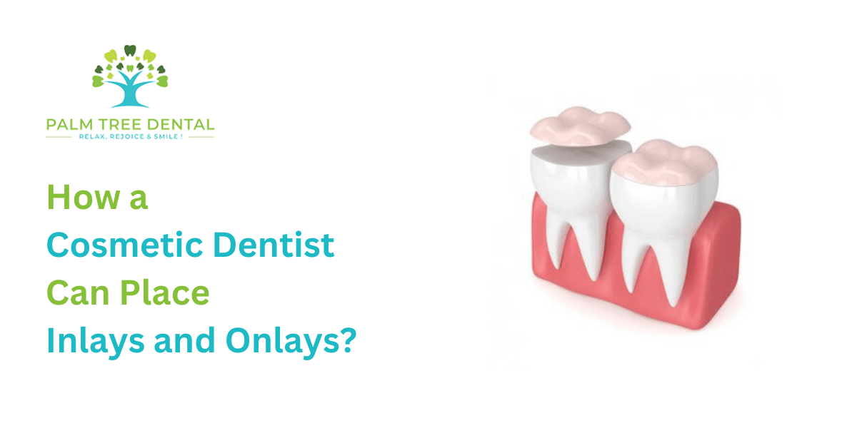 How a Cosmetic Dentist Can Place Inlays and Onlays
