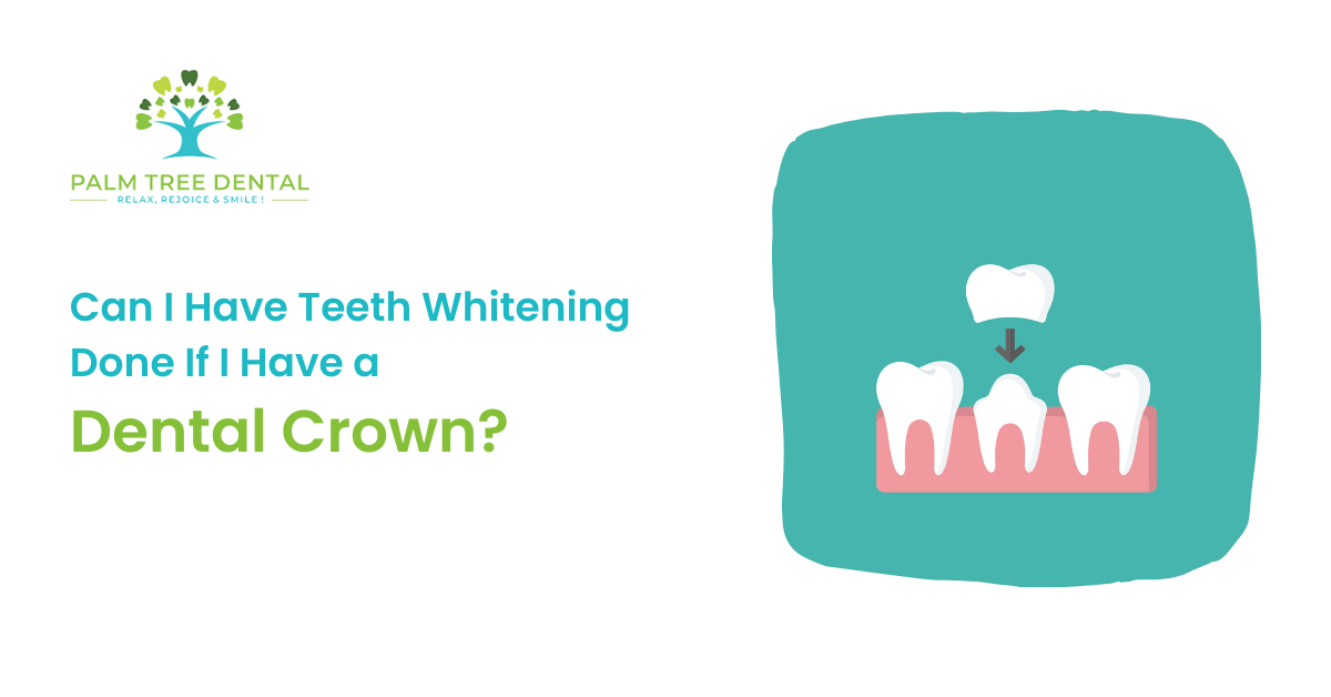 Can I Have Teeth Whitening Done If I Have a Dental Crown?