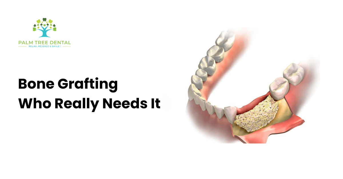 Bone Grafting: Who Really Needs It