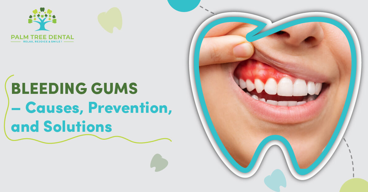 Bleeding Gums – Causes, Prevention, and Solutions