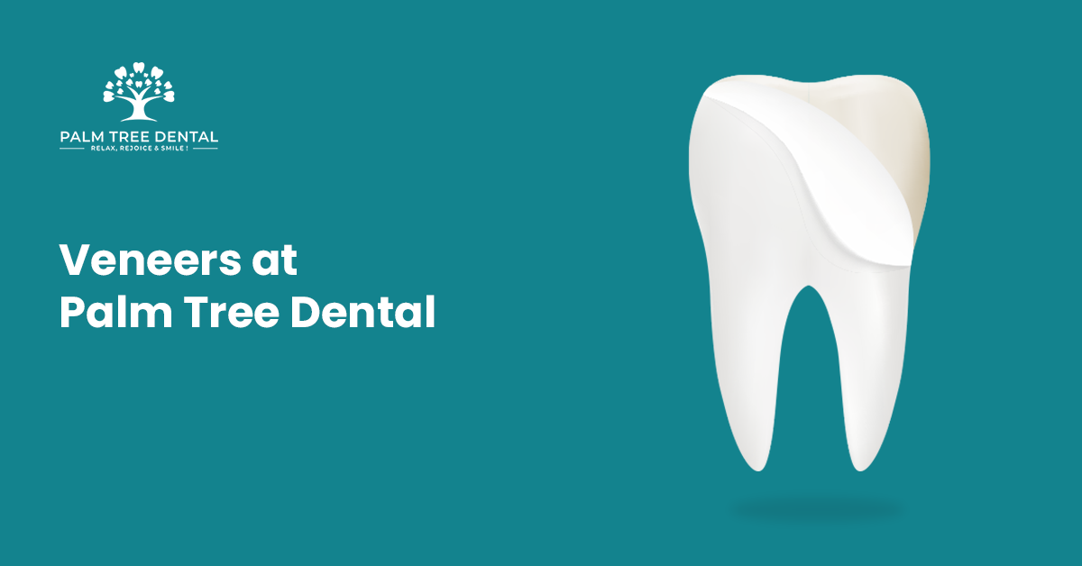 Veneers at Palm Tree Dental