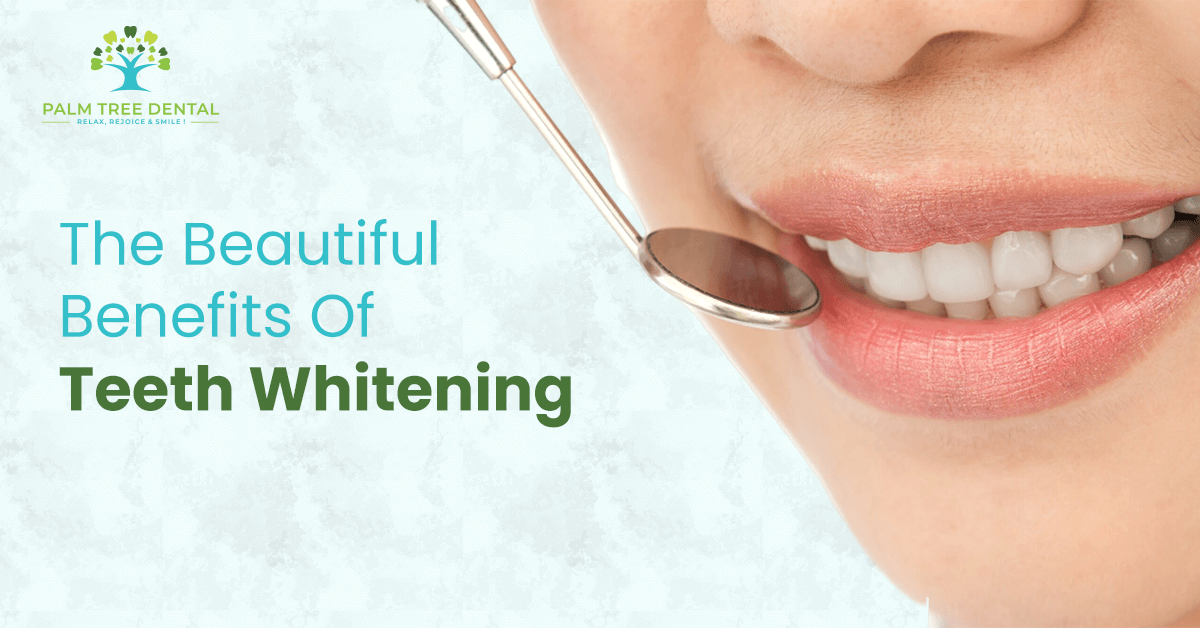 The Beautiful Benefits Of Teeth Whitening