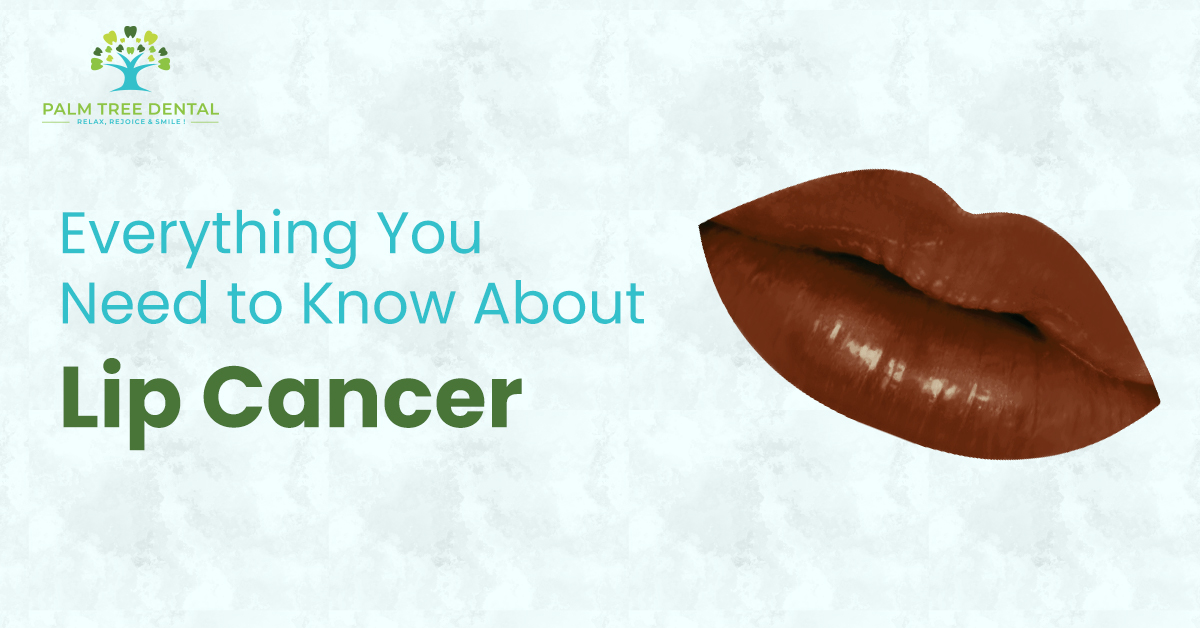 Everything You Need to Know About Lip Cancer