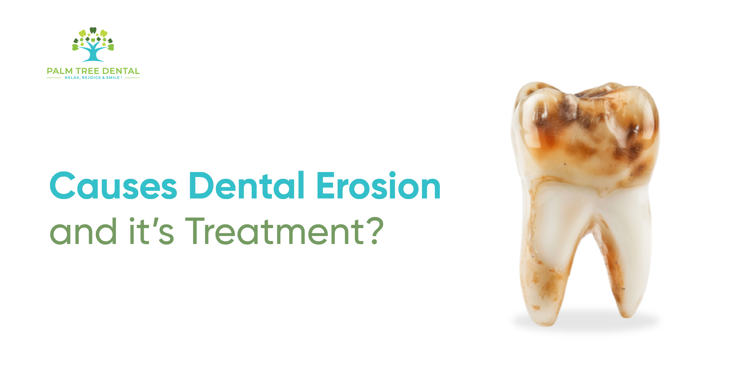 Causes of dental erosion and its treatment