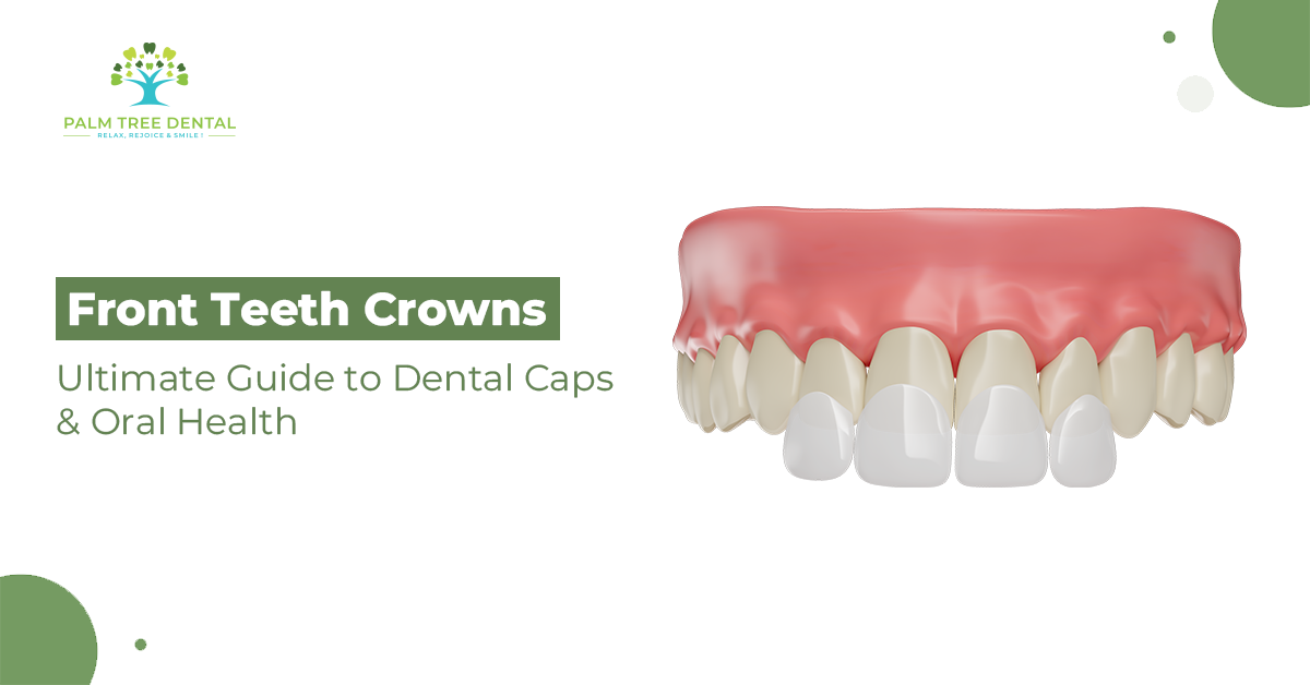 Front Teeth Crowns: Ultimate Guide to Dental Caps & Oral Health