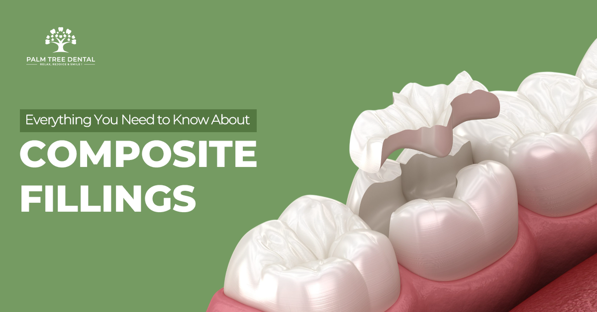 Everything You Must Know About Composite Fillings