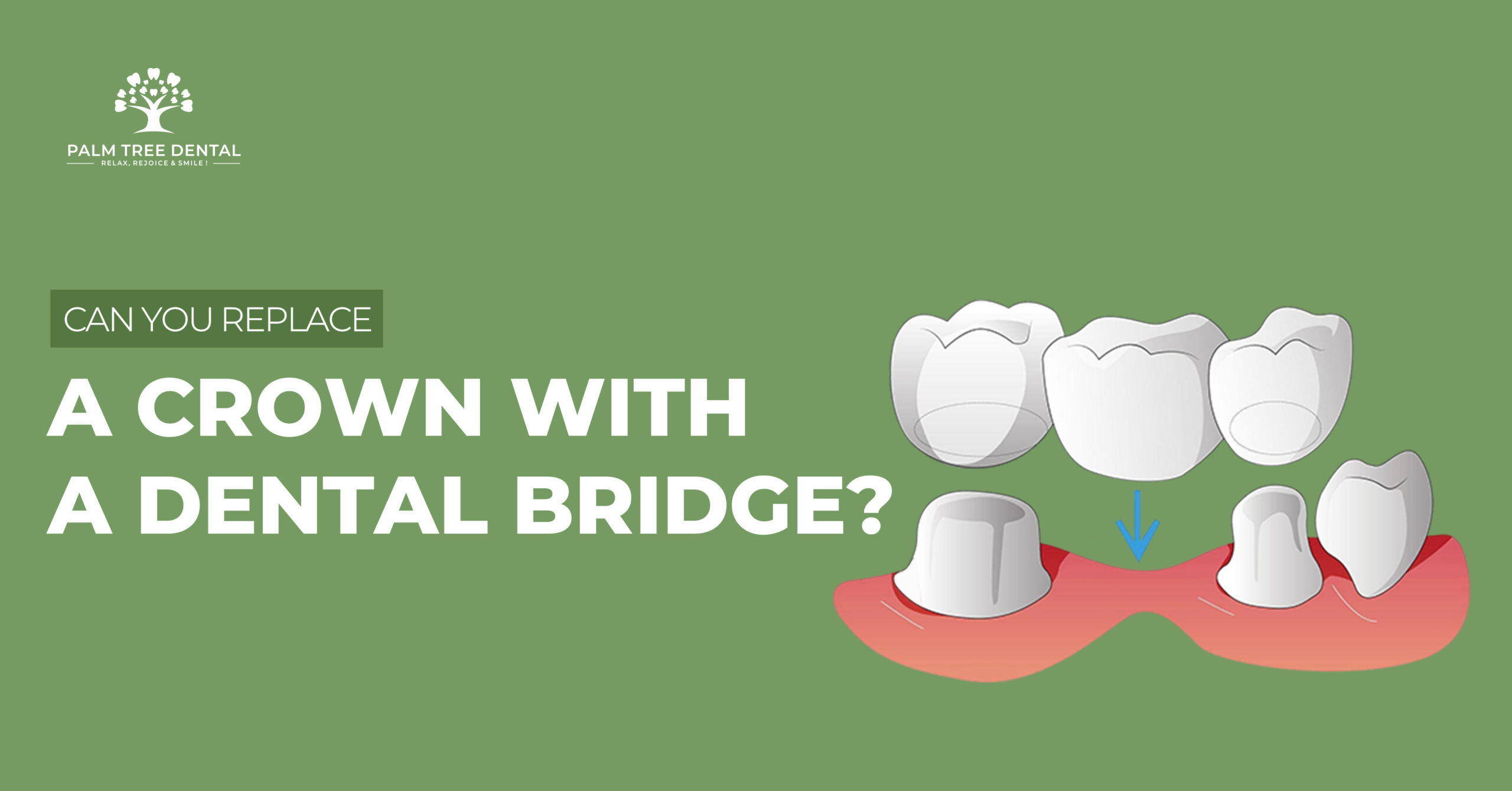 Can You Replace a Crown with a Dental Bridge?
