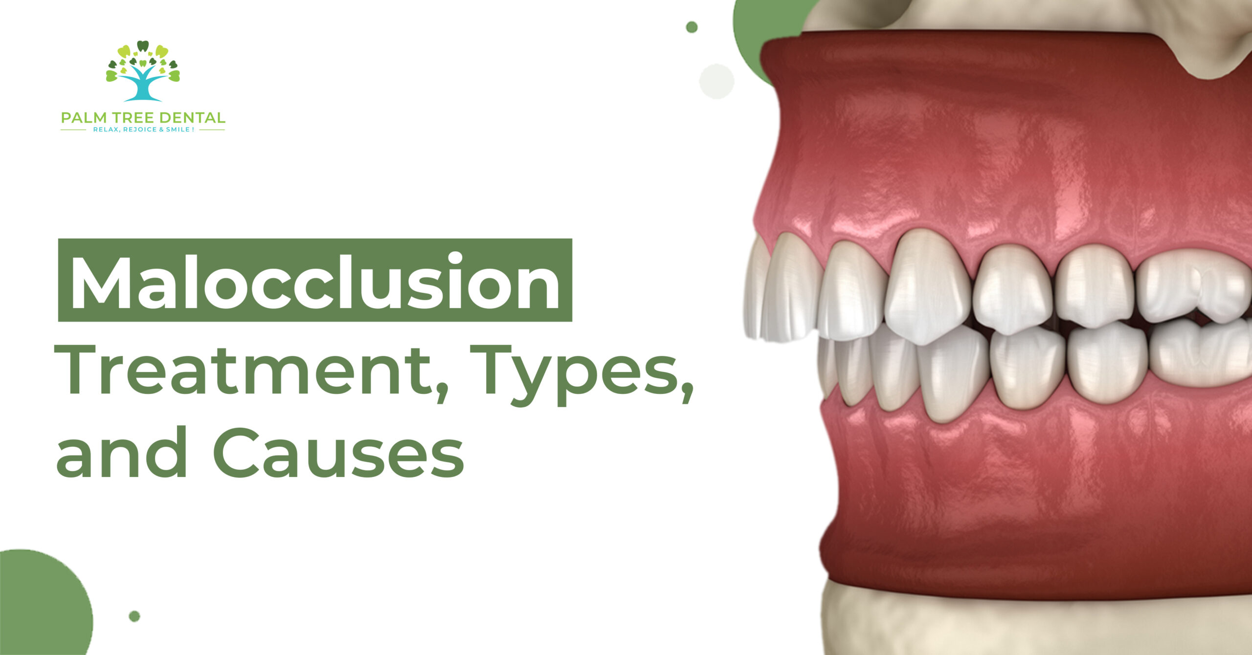 Malocclusion Treatment, Types, and Causes