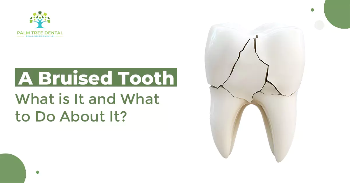 A Bruised Tooth: What is It and What to Do About It?