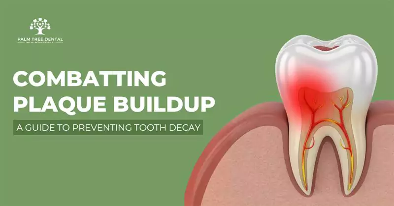 Combatting Plaque Buildup: A Guide to Preventing Tooth Decay