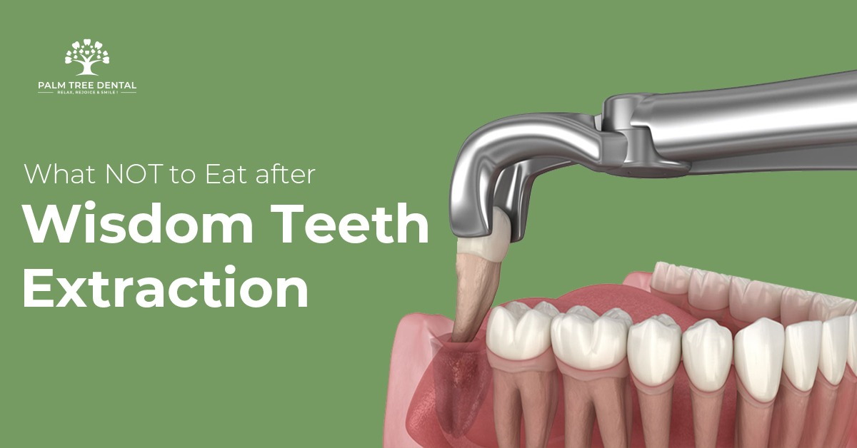 What NOT to Eat after Wisdom Teeth Extraction