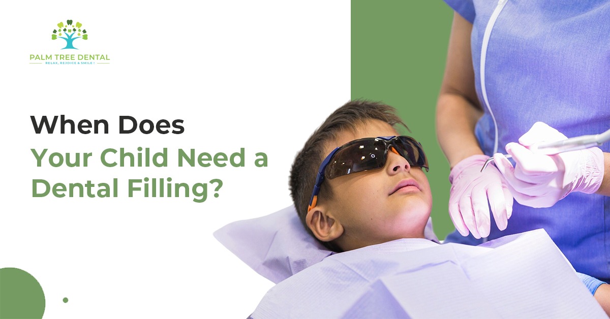 When Does Your Child Need a Dental Filling?