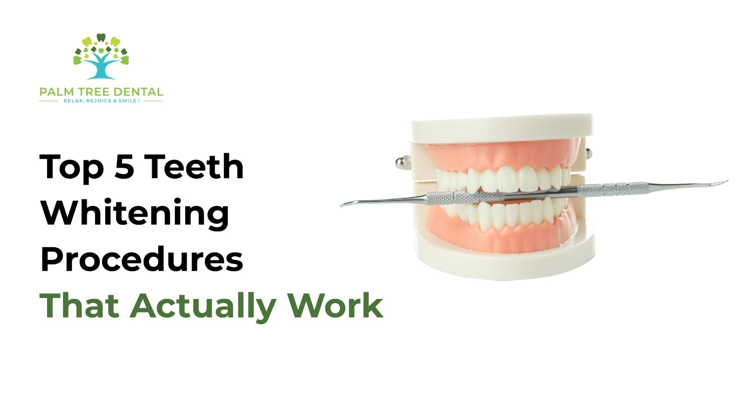 Top 5 Teeth Whitening Procedures That Actually Work